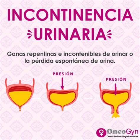Incontinencia Urinaria Oncogyn