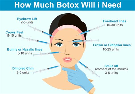 How Often To Get Botox For Migraines Botox For Migraines Can