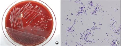 Bacillus Species Colony Morphology