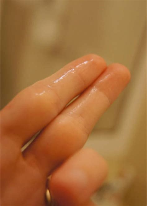 If you are not pregnant. What cervical mucus looks like through your cycle - Photo Gallery | BabyCenter