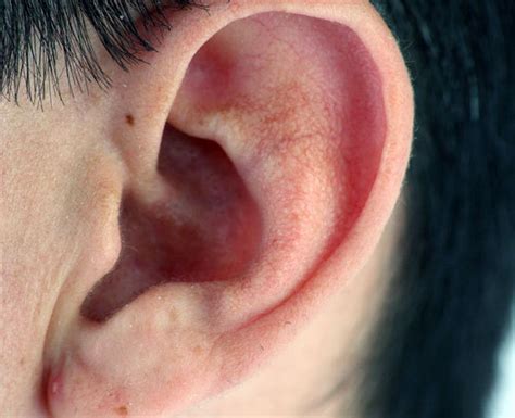 That Hissing Sound Could Be Tinnitus The Star
