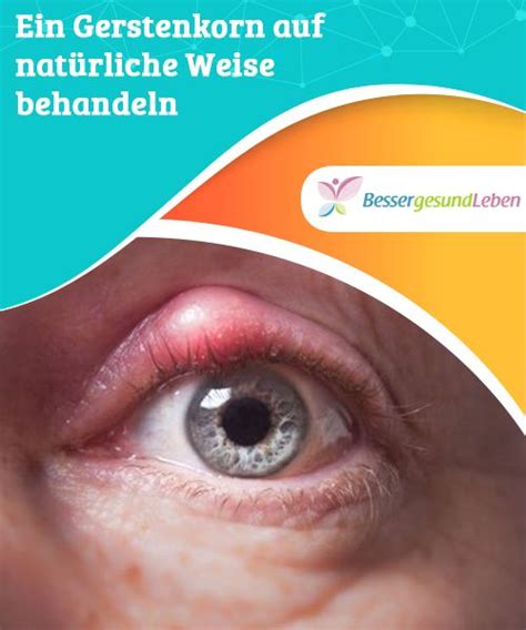 Häufig lässt sich die schnelle vibration auf relativ harmlose gründe wie stress, zu lange bildschirmarbeit. Ein Gerstenkorn auf natürliche Weise behandeln ...