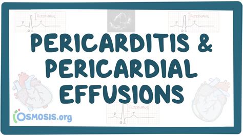 Pericarditis And Pericardial Effusion Osmosis Video Library