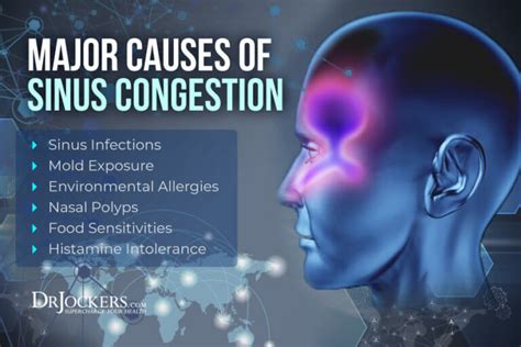 Sinus Congestion Causes Symptoms And Support Strategies