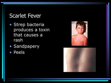 Ppt Streptococcal Serology Powerpoint Presentation Free Download