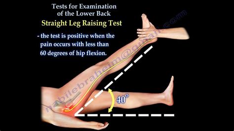 Tests For Examination Of The Lower Back Everything You Need To Know