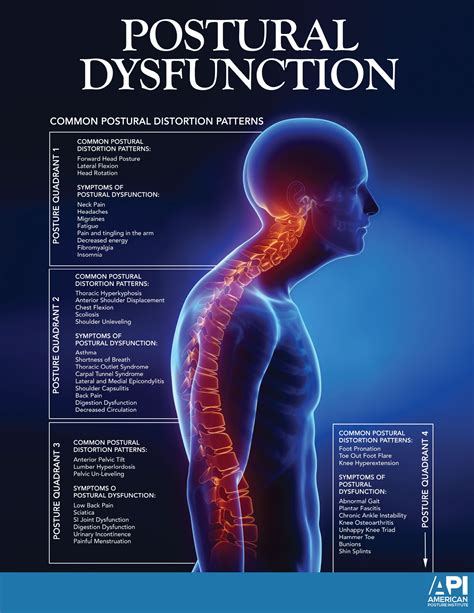 What Is Postural Dysfunction Advanced Chiropractic Albir
