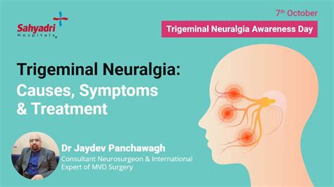 What Is Trigeminal Neuralgia Sahyadri Hospital