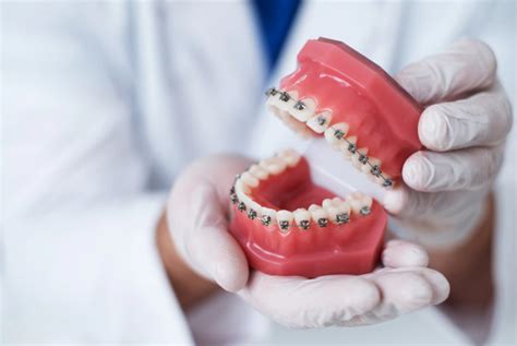 O Que é Ortodontia E Quais Tratamento Ela Abrange Vamos Te Contar Tudo