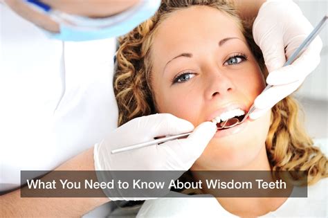 What You Need To Know About Wisdom Teeth Dentist Reviews Here