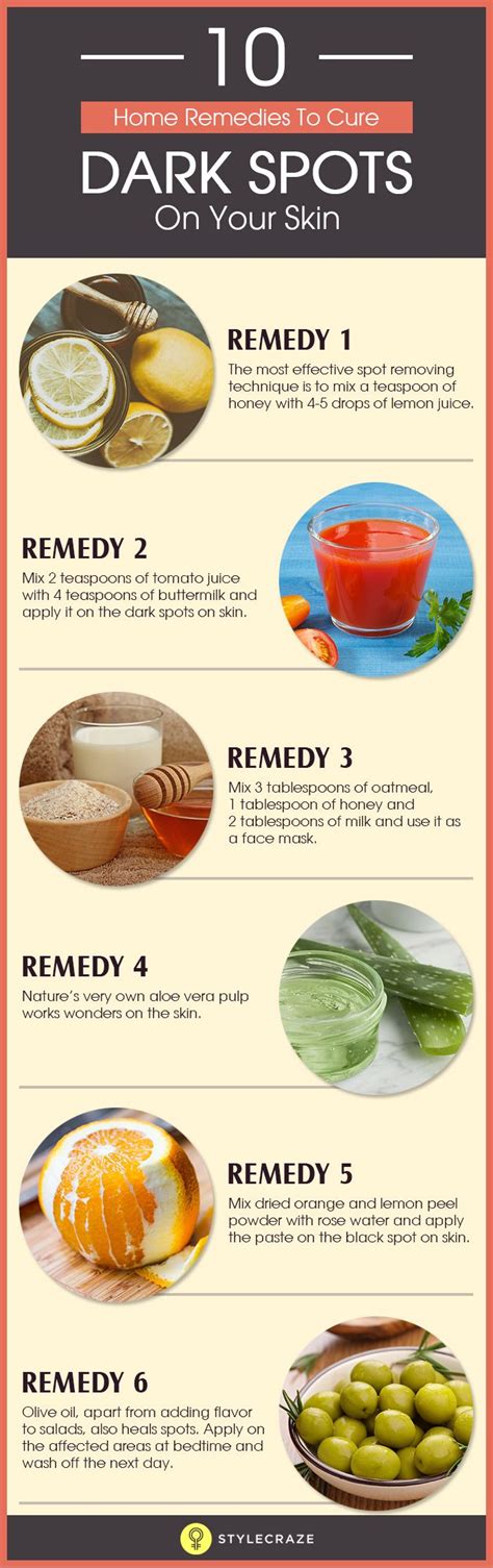 10 Natural Remedies For Curing Dark Spots On Your Skin Infographic