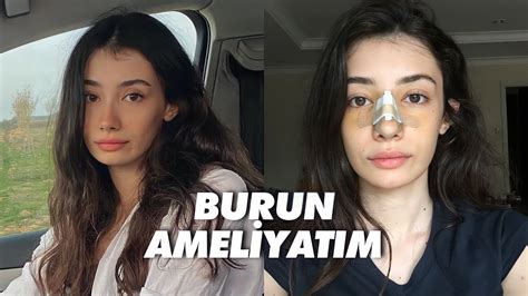 Burun Amelİyati SÜrecİm Burun Estetiği Youtube