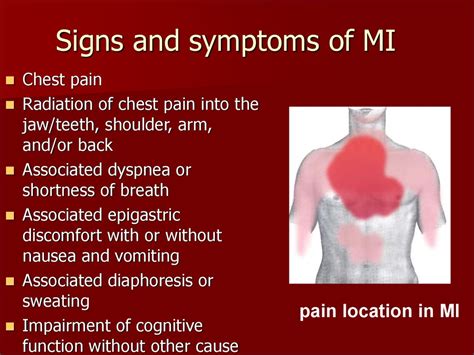 Epigastric Pain With Jaw Pain Carfareme 2019 2020