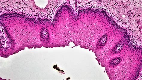 Epithelial Tissues Stratified Squamous Epithelium Flickr