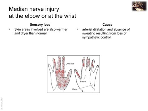 Applied Anatomy Median Nerve Injury