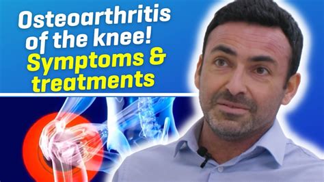 What Is Osteoarthritis Of The Knee Youtube