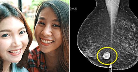 Breast Cancer Survivors Share The 5 Unlikely Symptoms Msians Must Look