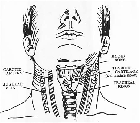 Neck Anatomy Diagram Image Result For Frontal View Human Skull