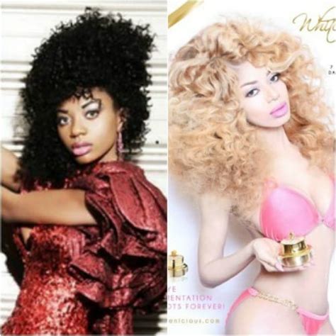 African Singer Dencia Encourages Skin Bleaching With Whitenicious