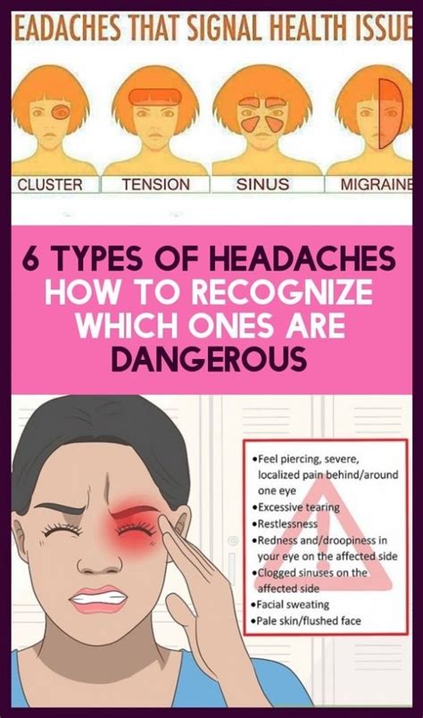 Tension Headache Tmj Information Aboutheadache