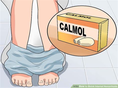 (2.3 vs 3.8) than the bipolar group. 3 Ways to Shrink Internal Hemorrhoids - wikiHow