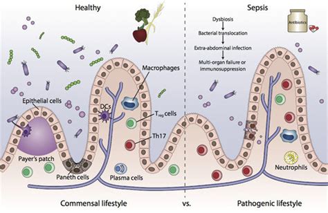 Dysbiosis And The Breakdown Of Immunological Tolerance In The Gut As A