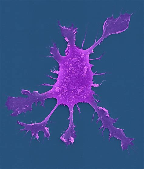 Human Dendritic Cell 18 Photograph By Dennis Kunkel Microscopyscience