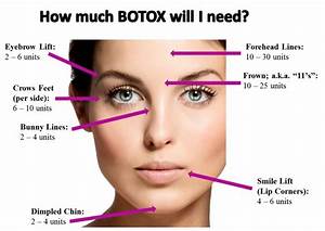 Pin By Sheena Wilt On Botox And Fillers Botox Injection Sites Botox
