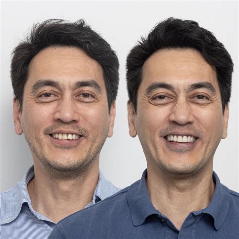 Russell Klein Dentures: The Celebrity Dentist's Secret Weapon