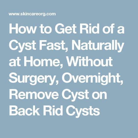 How To Get Rid Of A Cyst Fast Naturally At Home Without Surgery