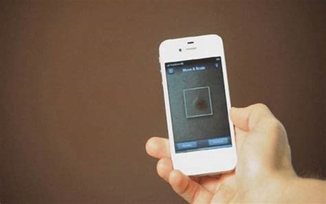تطبيق يكشف عن سرطان الجلد المبكر عبر صور السيلفي رووداونيت
