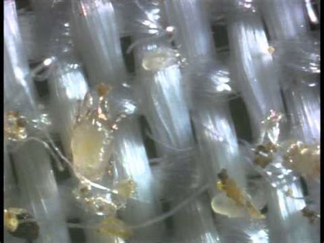 Here's when to toss them. Dust Mites Inside Pillow - YouTube