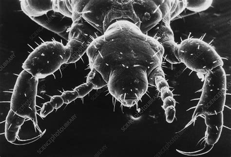 Human Body Louse Stock Image Z Science Photo Library