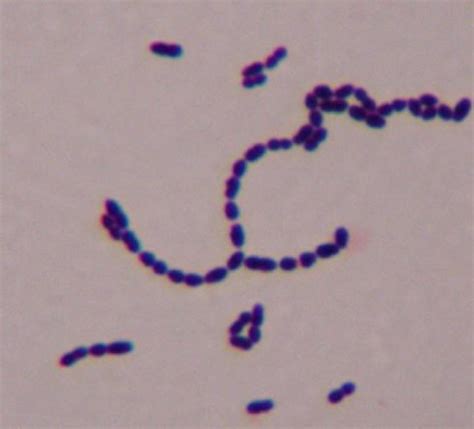 Gram Positive Diplococci In Chains