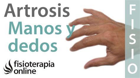 Tratamiento De Fisioterapia Para La Artrosis De Manos Y Dedos Masaje De Manos Terapia De La