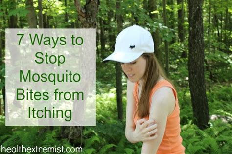 7 Natural Remedies For Mosquito Bites To Instantly Relieve The Itch