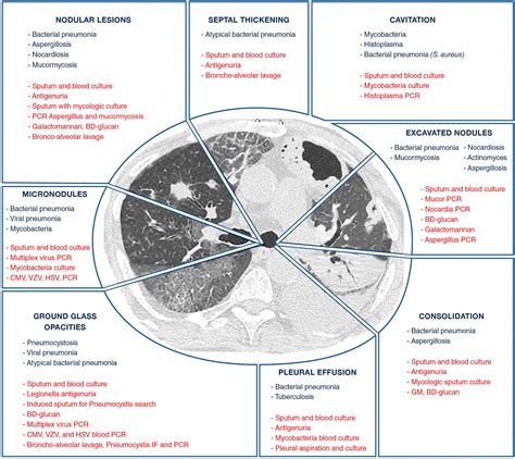 Etiologies Of Pulmonary Infections According To Ct Scan Grepmed