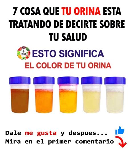 Lo Que Dice El Color De Tu Orina Sobre Tu Salud Noticias