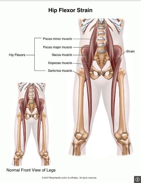 According to a small study published in the journal of orthopaedic & sports physical therapy in february 2013, keeping your hip muscles strong may help prevent poor movement patterns and stiffness from developing at the joint. 78+ images about Multifidus on Pinterest | Core exercises ...