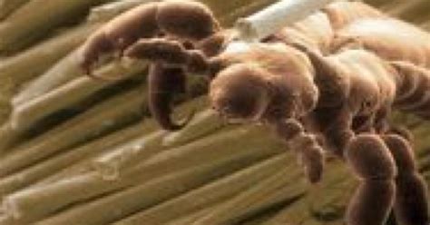 子どもの頭にたかるシラミ対策5選