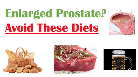 Foods To Avoid With Enlarged Prostate Reduce Symptoms And Risk Of Prostate Cancer Youtube