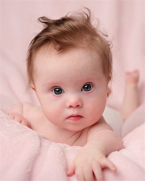 Beautiful Little Girl With Down Syndrome Beautiful Children Down