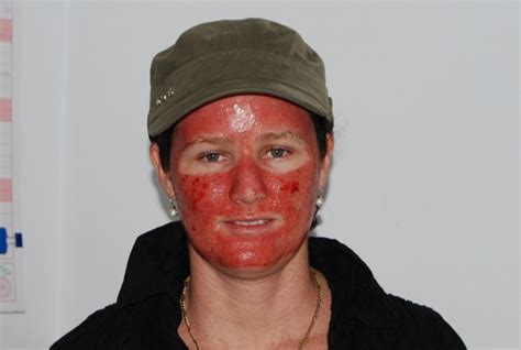 Maybe you would like to learn more about one of these? Twenty Four Seven: Thank you for Efudix Cream