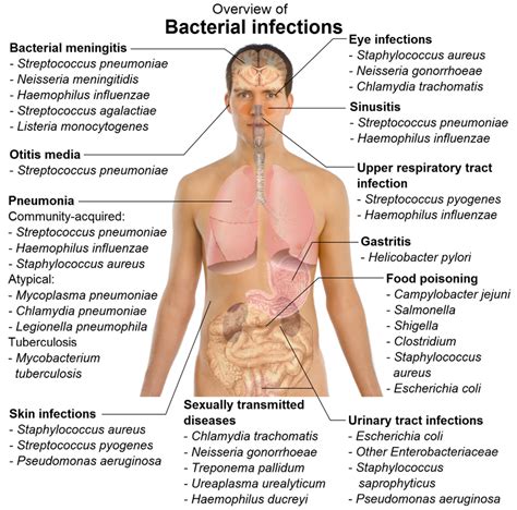 Learn different parts of the body in english with pictures: Infection and Disease - MICRO-PARA YOU KNOW!