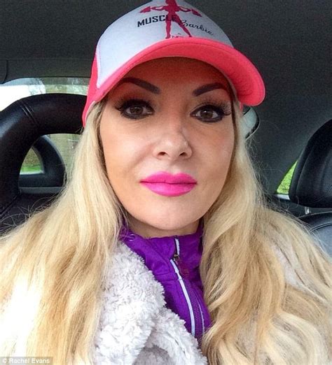 Rachel Evans Spends £20000 On Cosmetic Surgery And Fillers To Look Like Barbie Daily Mail Online