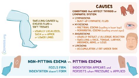 Non Pitting Edema What Is It Causes Diagnosis Treatment And More