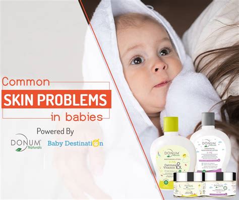Common Skin Problems In Babies