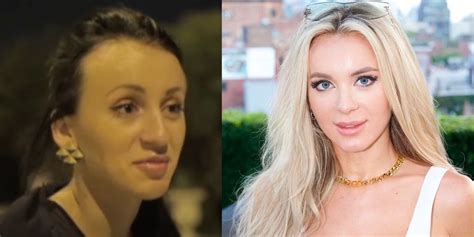 How 90 Day Fiancés Yaras Face Changed After Plastic Surgery Makeover