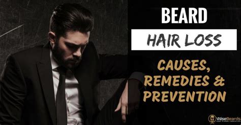 Beard Hair Loss Causes Remedies And Prevention