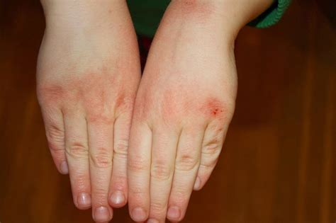 Check spelling or type a new query. Traditional remedy for rough, dry hands - Tehran Times
